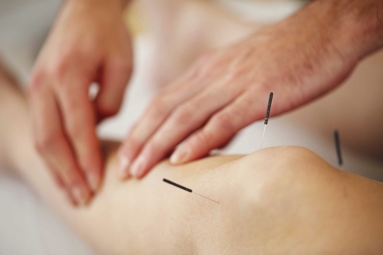 châm cứu tại nhà Đà Nẵng châm cứu tại nhà Đà Nẵng