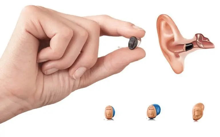 Báo Giá Máy Trợ Thính Và Top 5 Địa Chỉ Cung Cấp Uy Tín