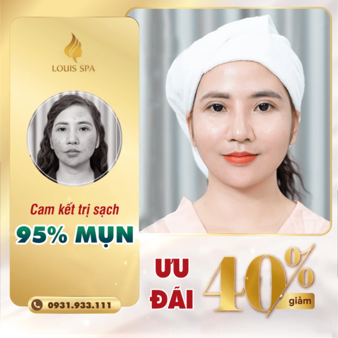 spa trị mụn Quảng Ngãi