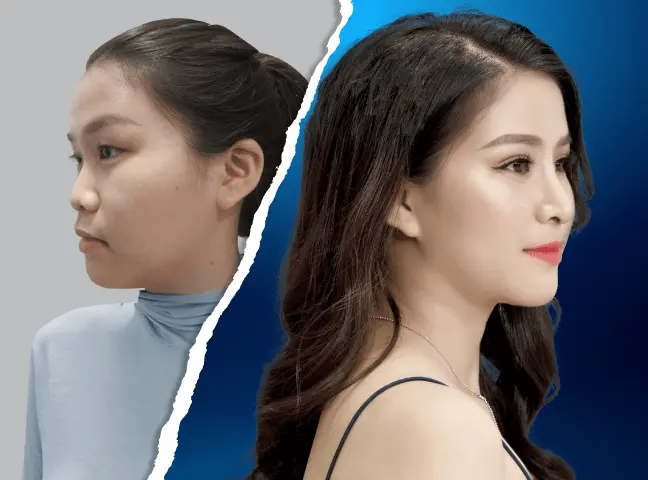 Đừng Bỏ Lỡ Top 10 Thẩm Mỹ Viện Tam Kỳ Chuyên Nghiệp Nhất