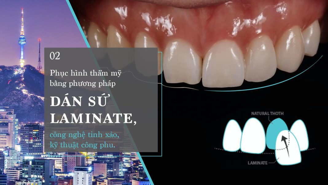 Bọc Răng Sứ TPHCM Bọc Răng Sứ TPHCM