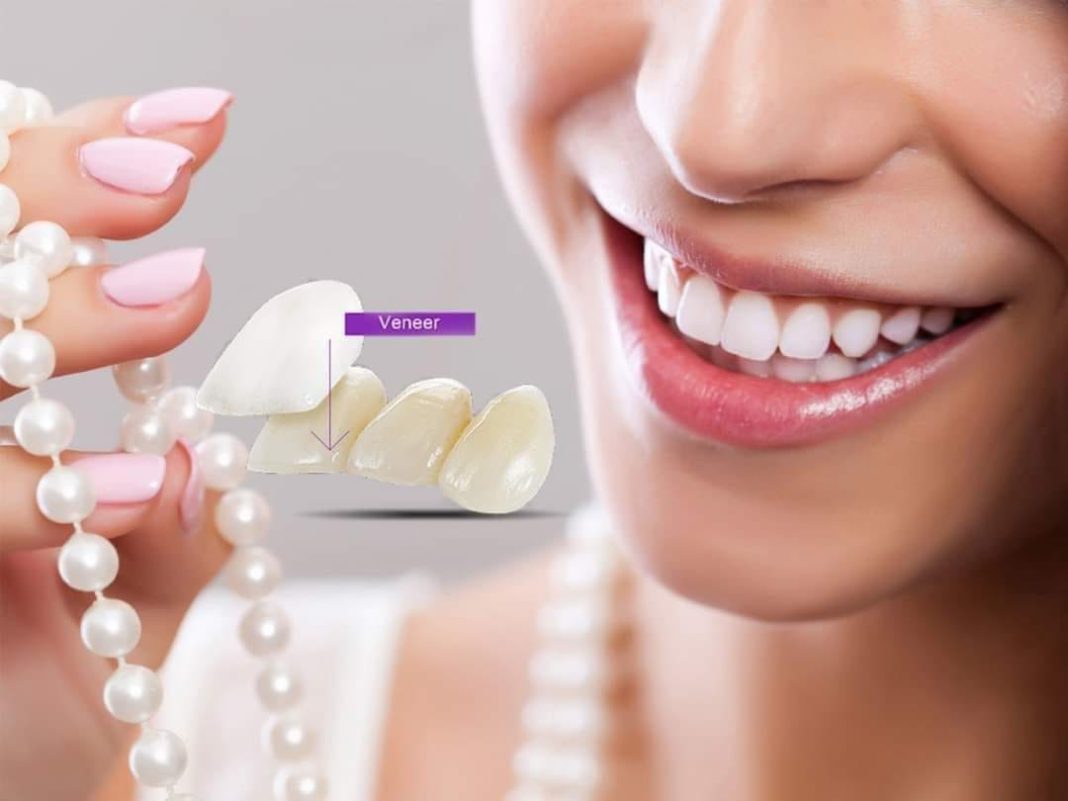 nha khoa đồng tháp Mỹ Anh