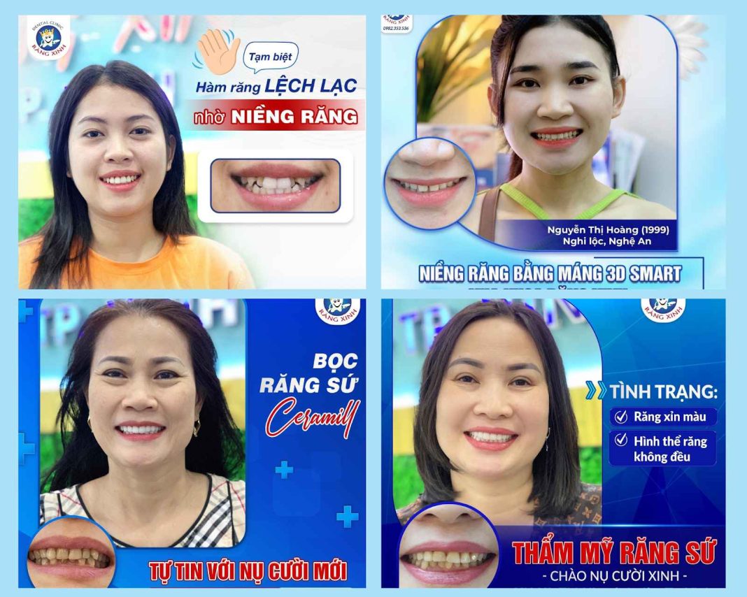 Nha Khoa Nghệ An Nha Khoa Răng Xinh Thành Phố Vinh