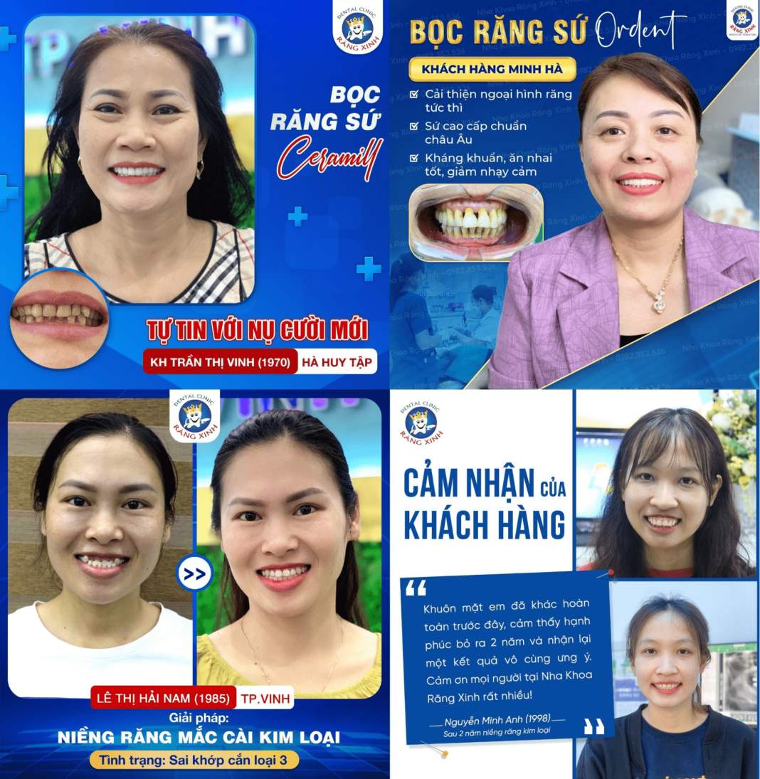 Nha Khoa Vinh Nha Khoa Răng Xinh - Top Địa Chỉ Nha Khoa Uy Tín Ở Vinh