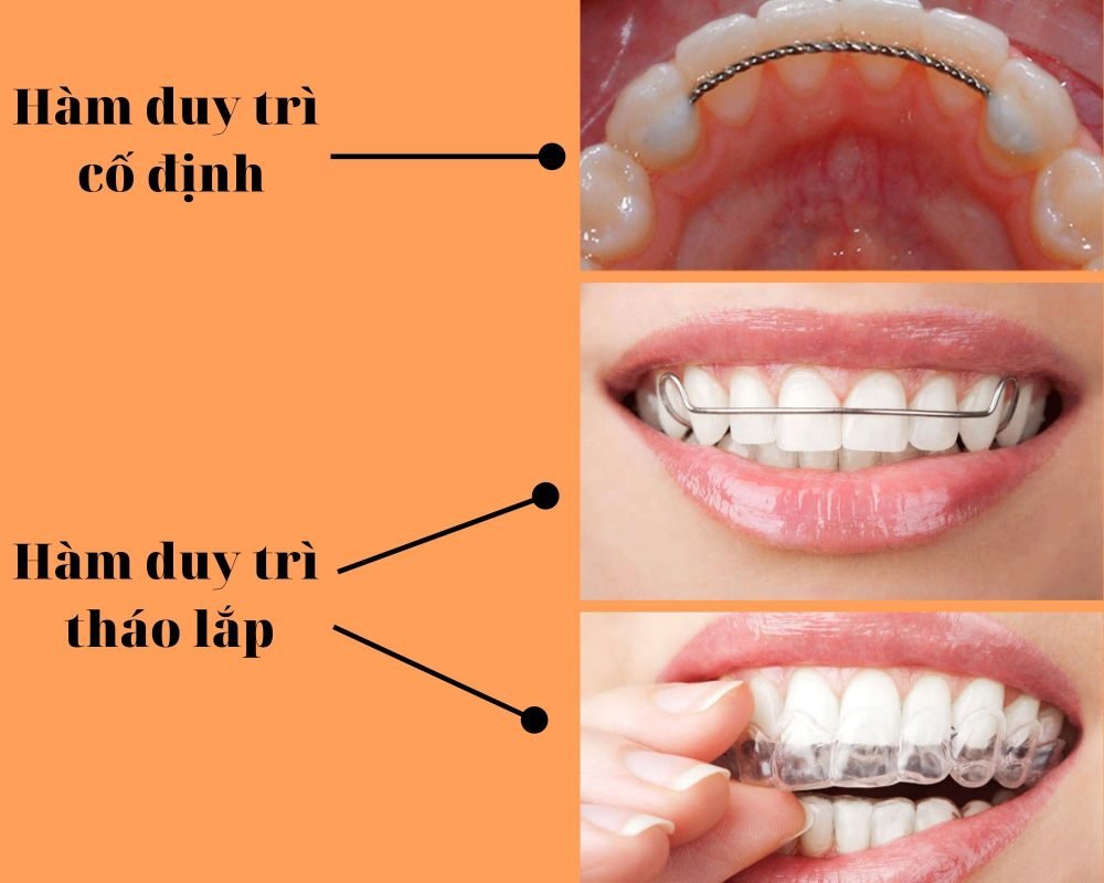 Nha Khoa Oreli