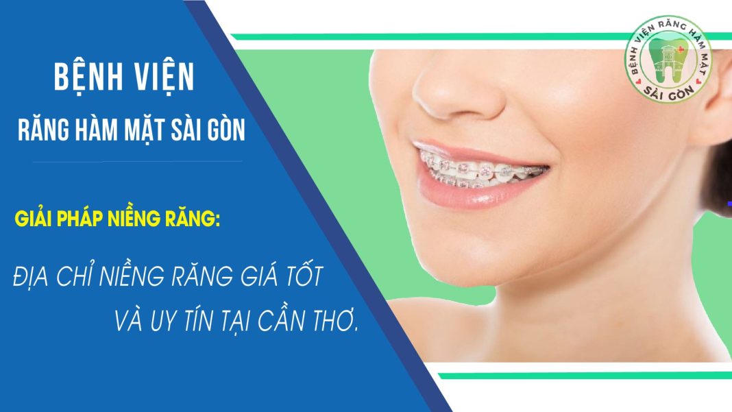 niềng răng Cần Thơ niềng răng Cần Thơ
