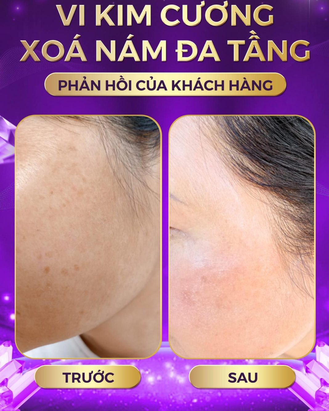 spa-cao-bang-5 Spa Cao Bằng