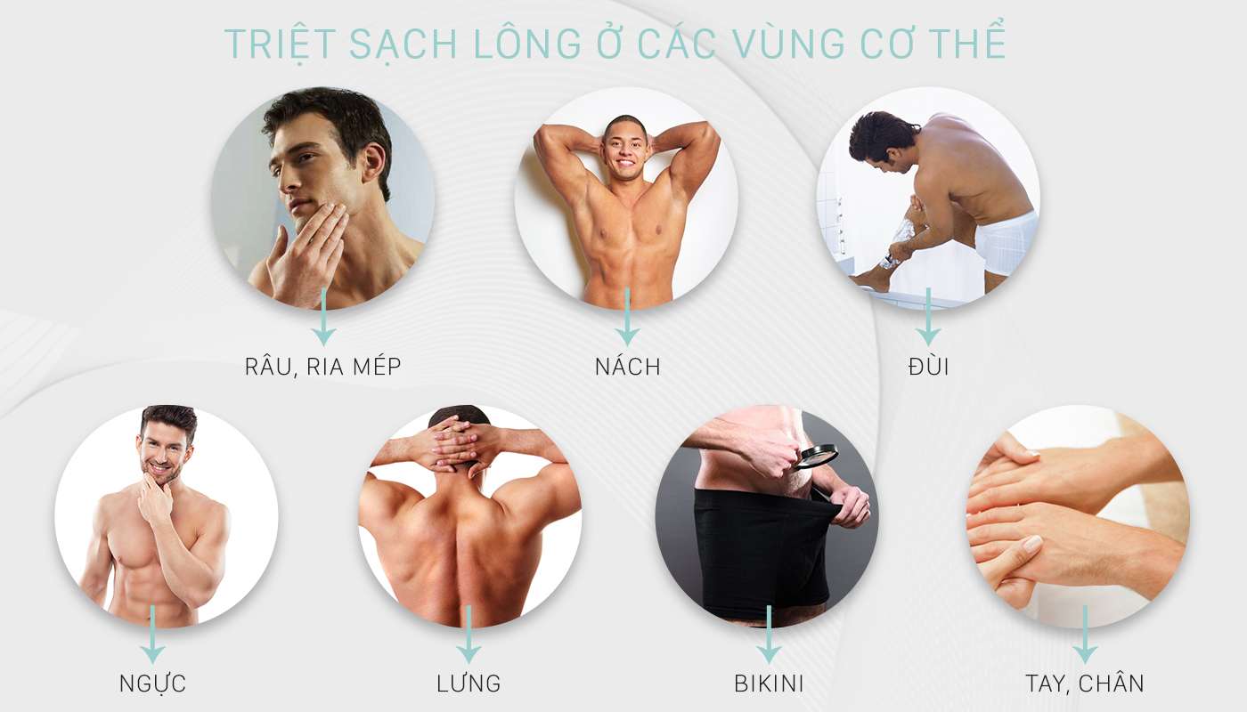 triệt lông cho nam giới ở TPHCM