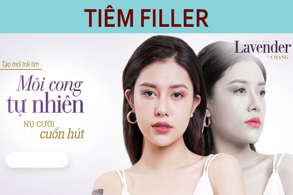 tiêm filler uy tín hà nội