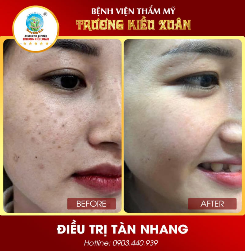 Trương Kiều Xuân