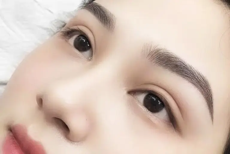 So sánh các phương pháp nâng mũi hiện nay: Ưu và nhược điểm