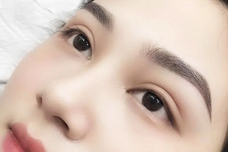 So sánh các phương pháp nâng mũi hiện nay: Ưu và nhược điểm