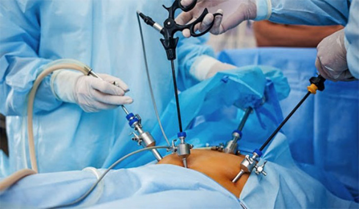 Các loại nội soi phổ biến: Nội soi dạ dày, đại tràng, tai mũi họng các loại nội soi phổ biến nội soi dạ dày đại tràng tai mũi họng