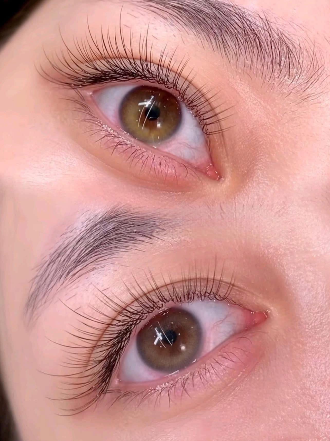 nối mi vĩnh phúc