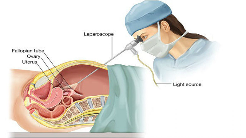quy trình nội soi có đau không cần chuẩn bị gì quy trình nội soi có đau không, cần chuẩn bị gì
