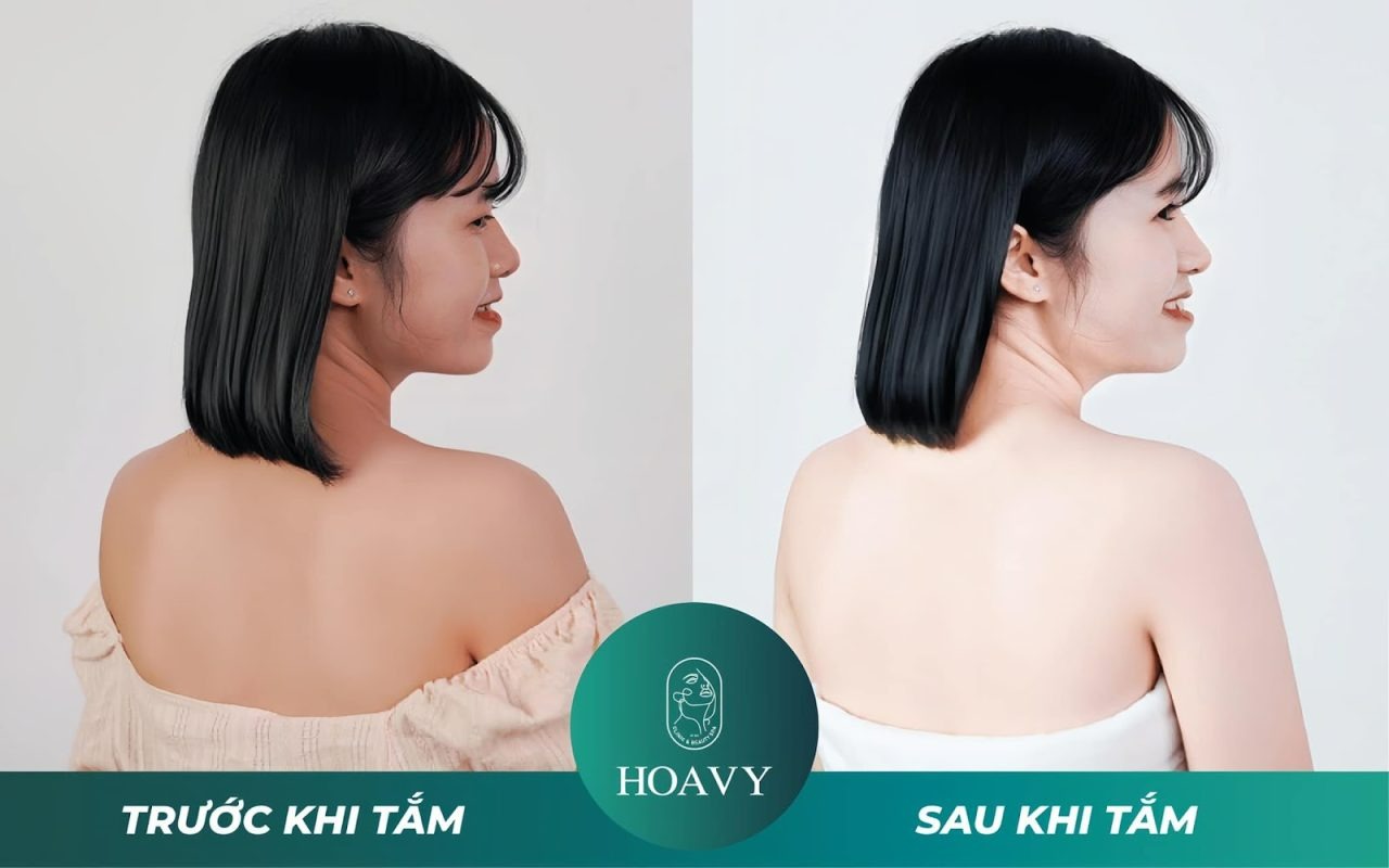 tắm trắng Hải Phòng