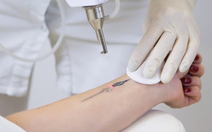 Xoá xăm Đà Nẵng - Thẩm mỹ Viện Đông Á