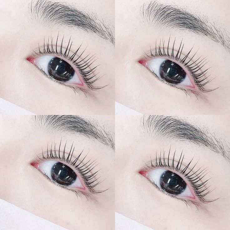 nối mi thái bình